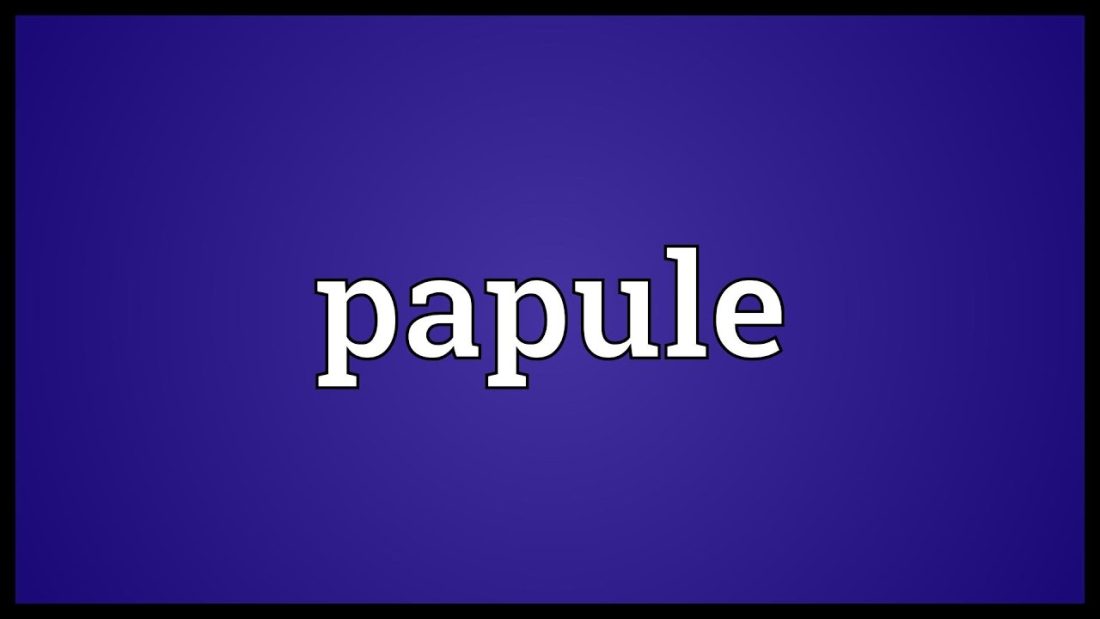 papule piezogeniche