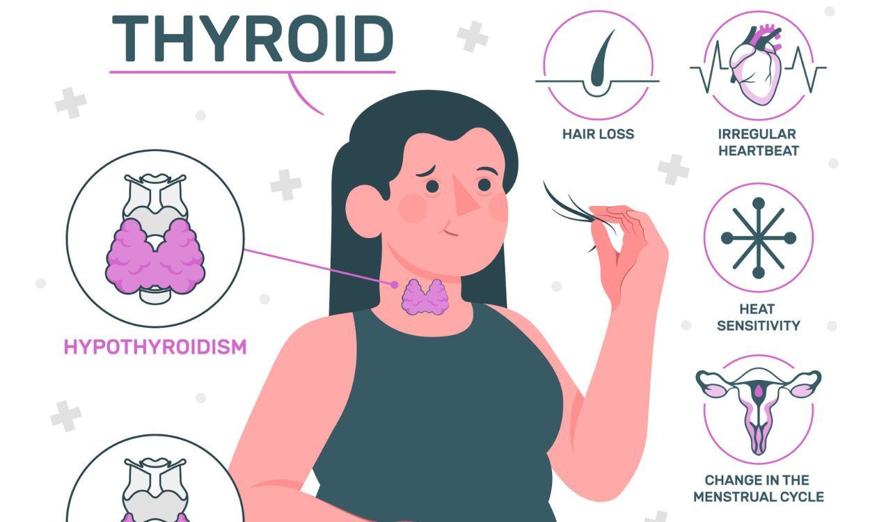 subclinical hyperthyroidism