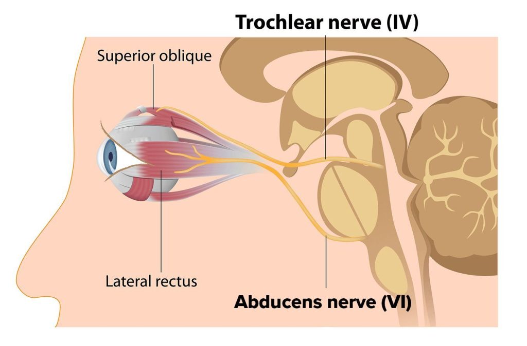 trochlear nerve