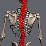 depomethod scoliosis