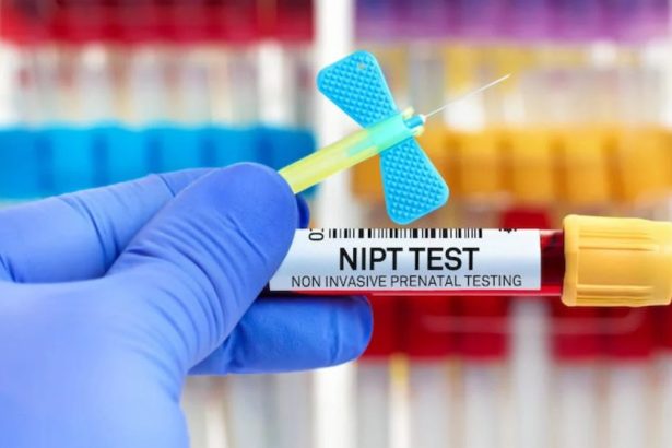 nipp testing near me