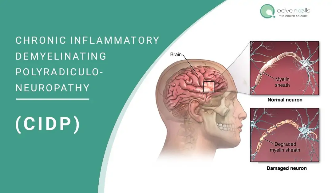 chronic inflammatory polyneuropathy