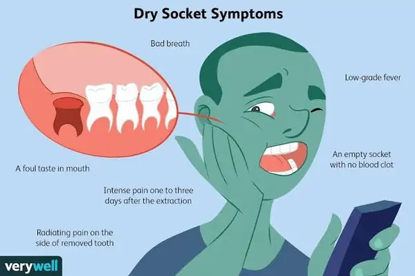 i accidentally rinsed my mouth after tooth extraction