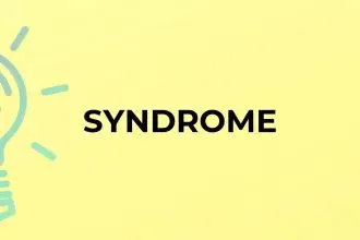 kbg syndrome