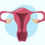 uterine fibromyomata